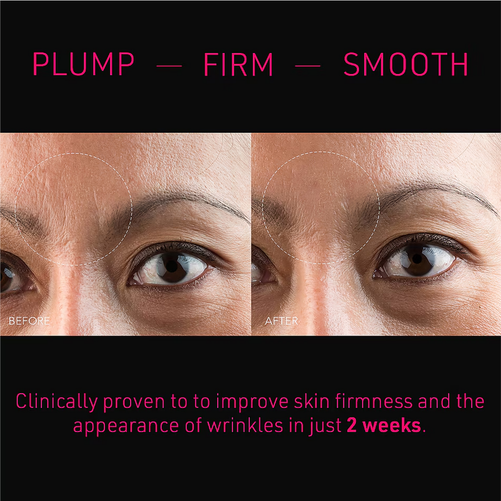 wedoskin FOREO FAQ Microneedling patches for forehead, skincare mask with tiny needles for rejuvenation, displayed on a white background