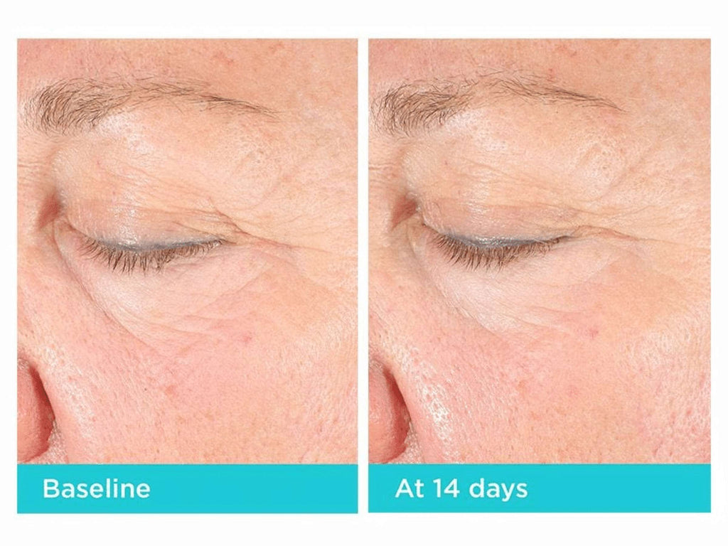 Neocutis Lumière Firm Riche Eye Cream before and after images showing improved skin around the eyes.