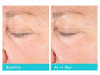 Neocutis Lumière Firm Riche Eye Cream before and after images showing improved skin around the eyes.