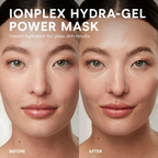 NuFACE IonPlex Hydra-Gel Power Mask from wedoskin, showing before and after skincare results in a five-pack of masks and peels.
