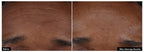 Side-by-side before and after images showing SkinCeuticals P-TIOX needle-free anti-wrinkle serum reducing fine lines on facial skin.