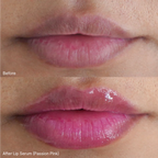 wedoskin Revive7 Lip Serum Passion Pink for lips, showcasing smooth, glossy lips with a hint of pink color and sleek packaging.