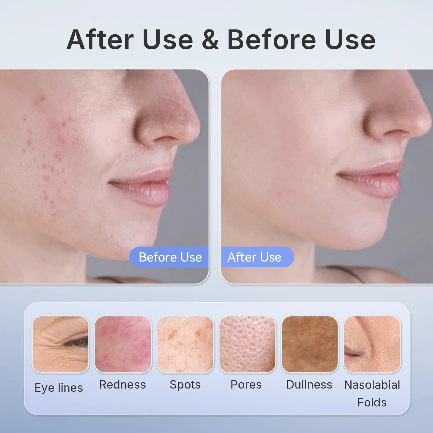 MediSpa Aesthetica 510K wireless near-infrared and red light facial mask for anti-aging and skin rejuvenation therapy.