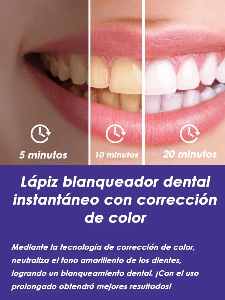 MediSpa Aesthetica instant teeth whitening pen packs with sleek white pens and caps, designed for quick at-home teeth whitening.