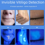 UVA Lamp Skin Analyzer