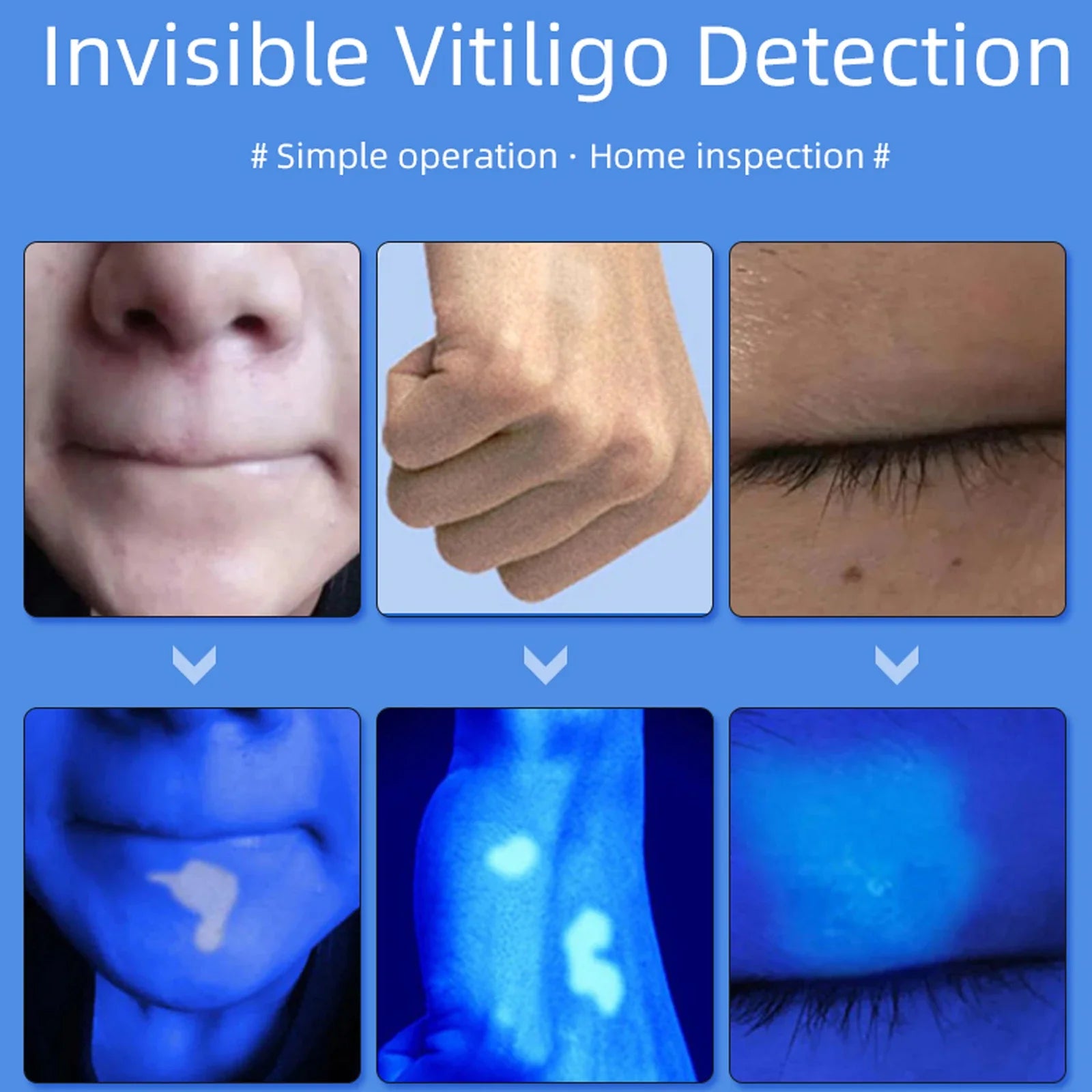 UVA Lamp Skin Analyzer
