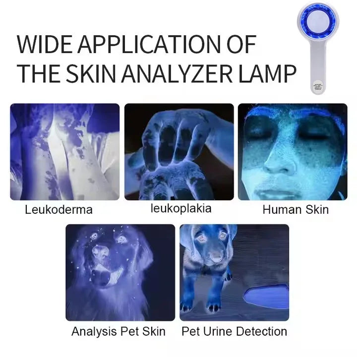 UVA Lamp Skin Analyzer