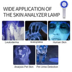UVA Lamp Skin Analyzer