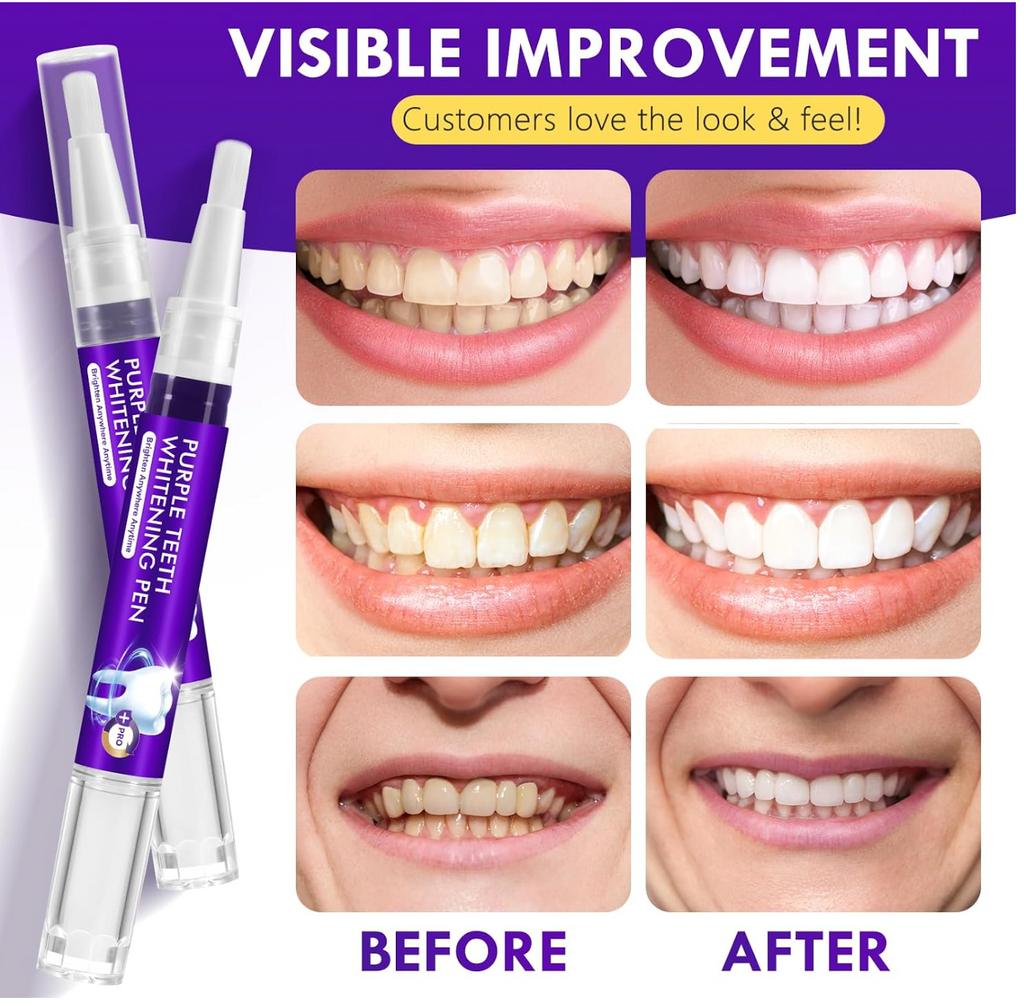 MediSpa Aesthetica instant teeth whitening pen packs showing white pen applicators and packaging for at-home teeth whitening.