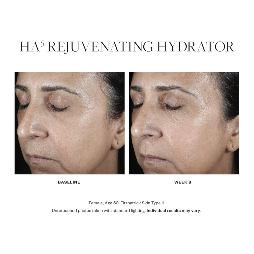 Before and after images of wedoskin SkinMedica HA5 Rejuvenating Hydrator showing improved skin hydration and smoothness.