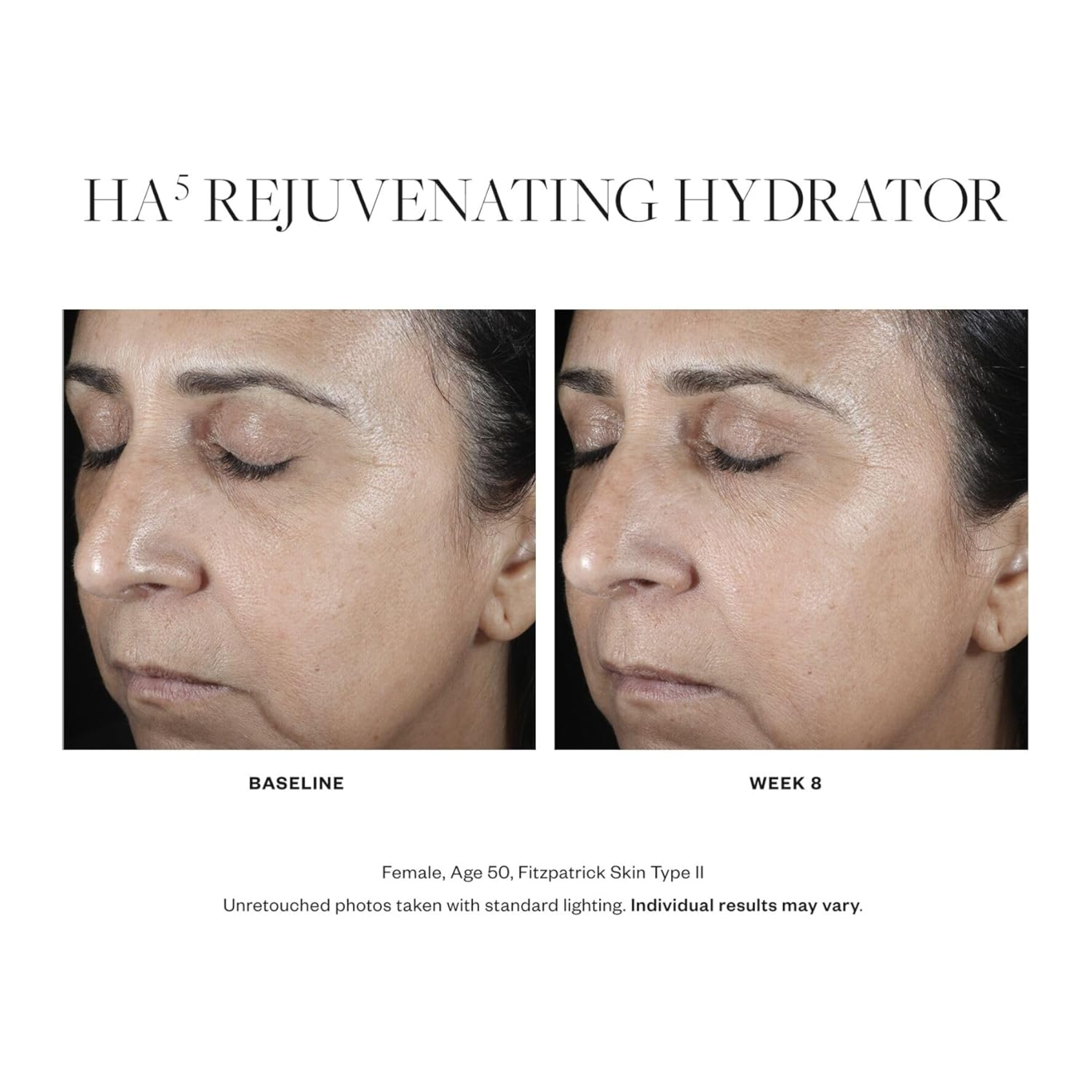 Before and after images of wedoskin SkinMedica HA5 Rejuvenating Hydrator showing improved skin hydration and smoothness.