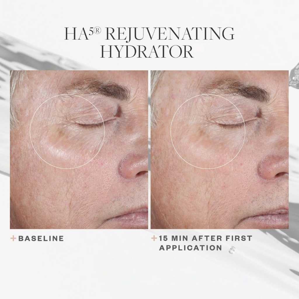 SkinMedica HA5 Rejuvenating Hydrator moisturizer bottle with before and after skin appearance images, showcasing skin hydration benefits.