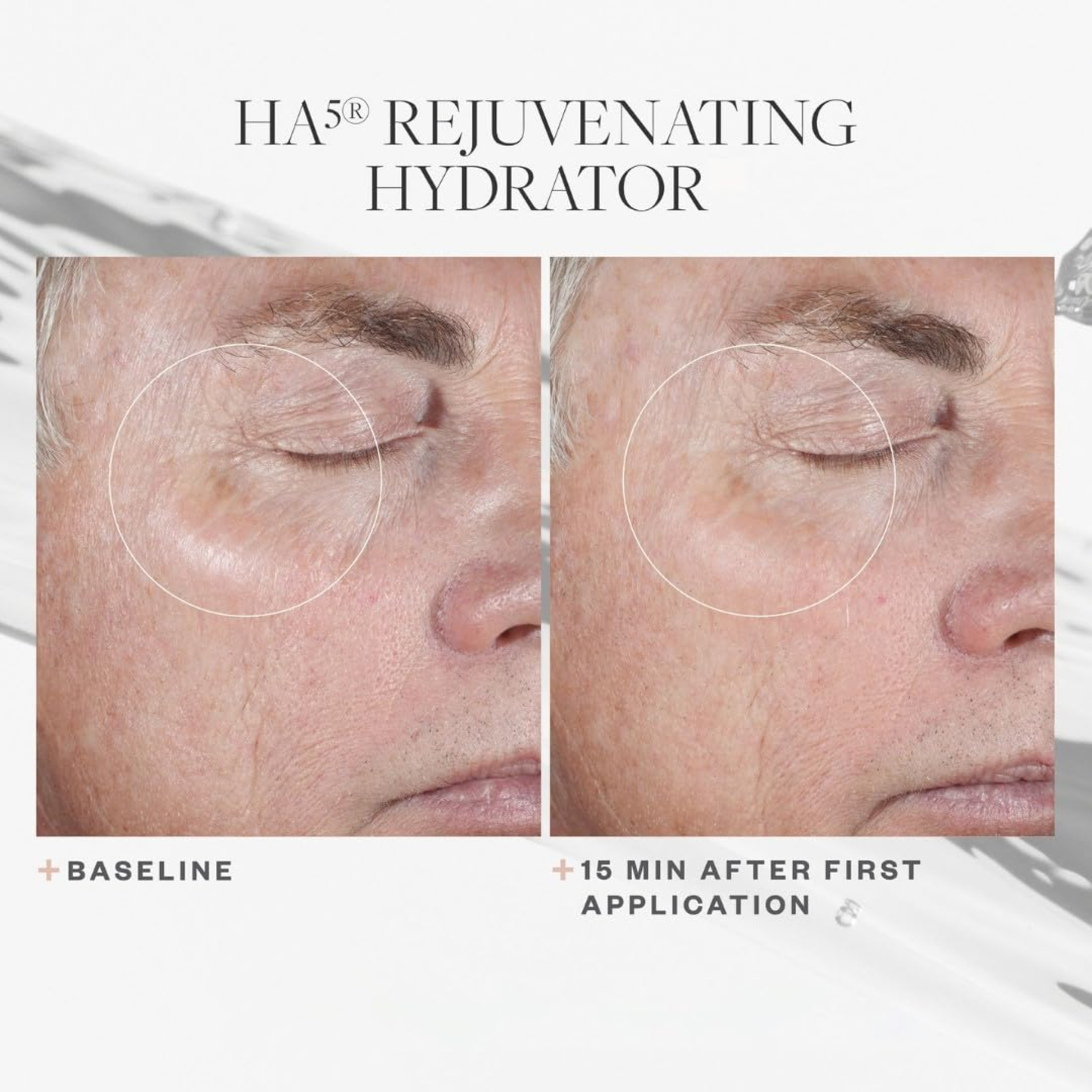 SkinMedica HA5 Rejuvenating Hydrator moisturizer bottle with before and after skin appearance images, showcasing skin hydration benefits.