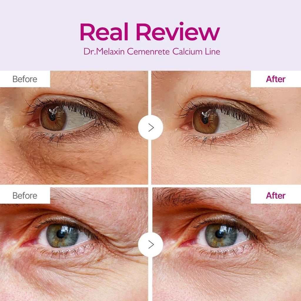 Lakinza Dr. Melaxin Cementrete Calcium Dark Spot Eye Cream 15g, featuring a sleek tube with a precision applicator for dark spot treatment.