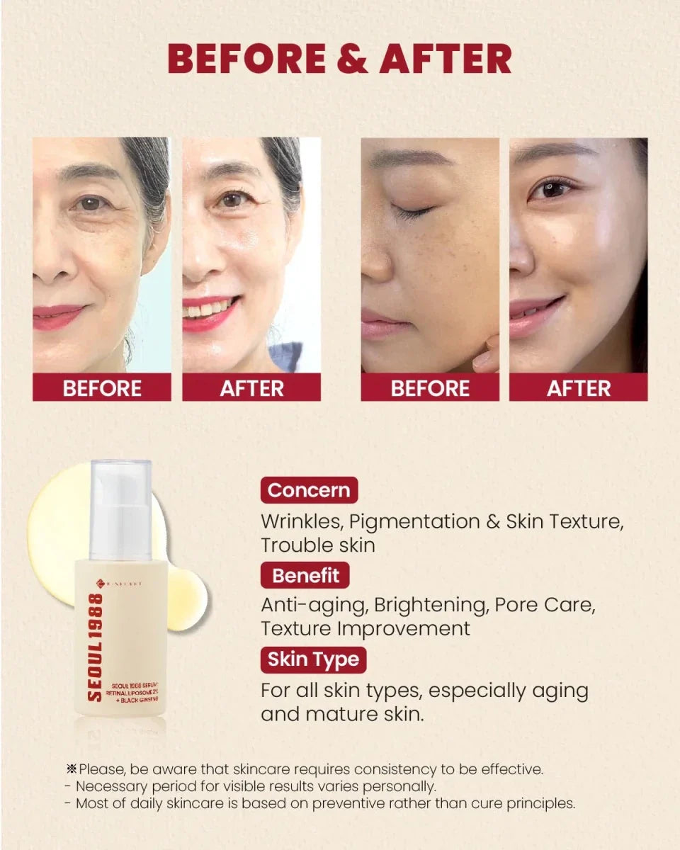 Lakinza K-beauty Seoul 1988 Serum with retinal liposomes and black ginseng in a 30ml bottle, skincare serum for brightening and anti-aging.