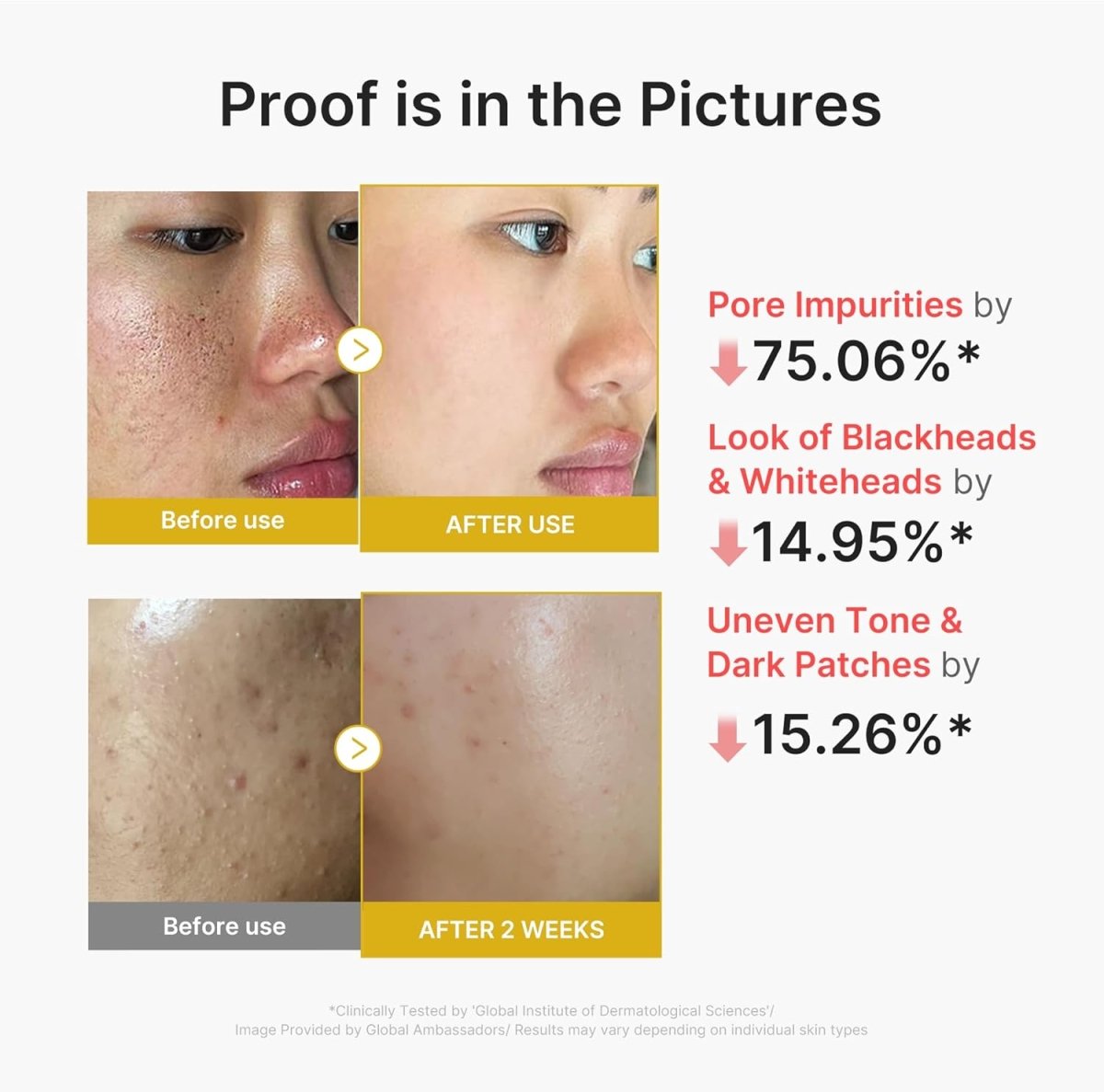 Lakinza K-beauty Medicube Kojic Acid Turmeric Peel Shot serum bottle, 80ml, with bright yellow label and product details visible
