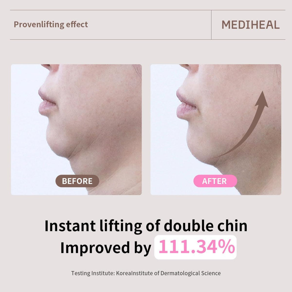 Mediheal Retinol Collagen Cream Lifting Mask by Lakinza K-beauty, 30ml, skincare mask with retinol and collagen for firming.