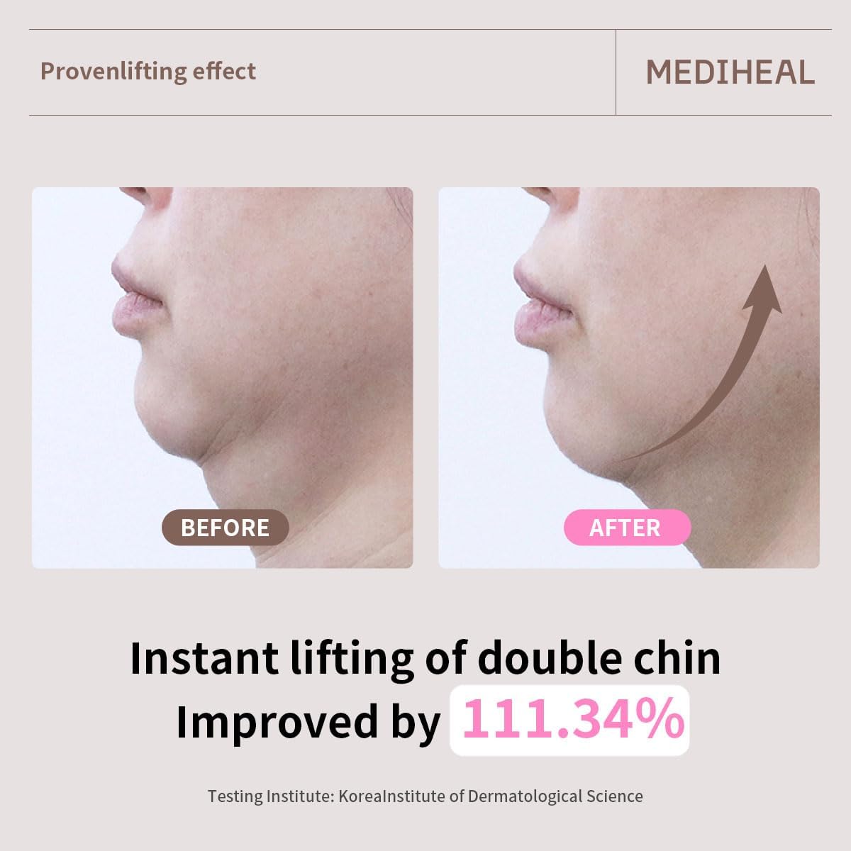 Mediheal Retinol Collagen Cream Lifting Mask by Lakinza K-beauty, 30ml, skincare mask with retinol and collagen for firming.